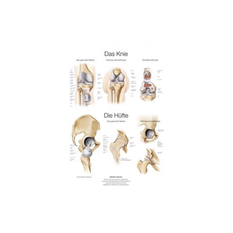 Az emberi térd és csípő - plakát
